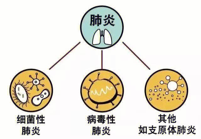 肺炎是怎么造成的呢「3小时喝3升水」 餐饮业务